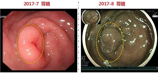 疫情下的彩虹桥