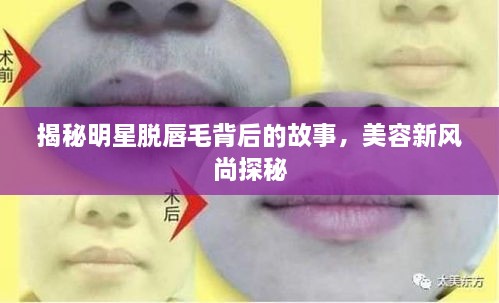 揭秘明星脱唇毛背后的故事，美容新风尚探秘