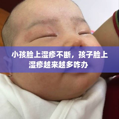 小孩脸上湿疹不断，孩子脸上湿疹越来越多咋办 