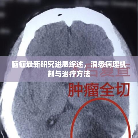 脑疝最新研究进展综述，洞悉病理机制与治疗方法