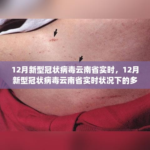 云南省实时状况下的多元观点探析，12月新型冠状病毒动态观察