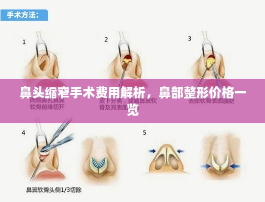 鼻头缩窄手术费用解析，鼻部整形价格一览