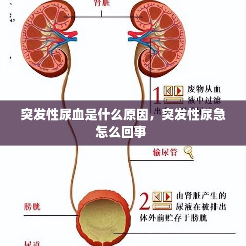 突发性尿血是什么原因，突发性尿急怎么回事 